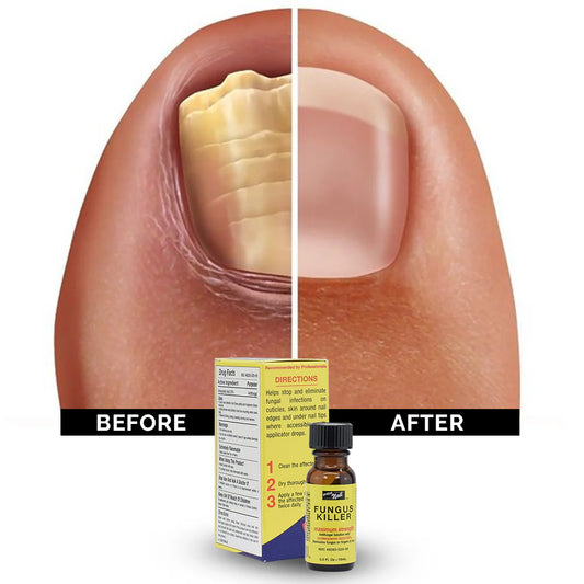 Monika Pro Fungus Killer Treatment 0.5 oz