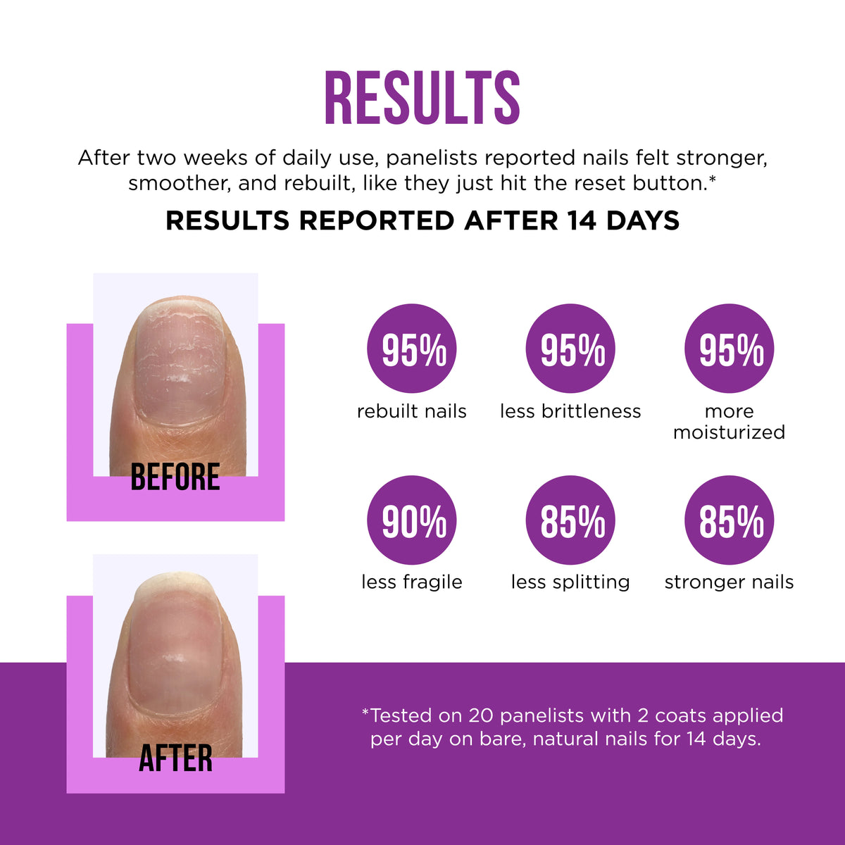ORLY Nail Rescue Bond Repair Serum 0.6 fl oz #2400021
