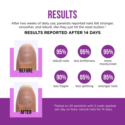 ORLY Nail Rescue Bond Repair Serum 0.6 fl oz #2400021