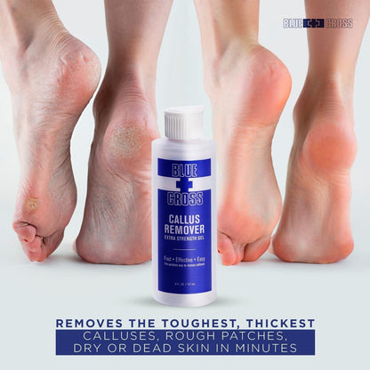Blue Cross Callus Remover Callous 32 oz