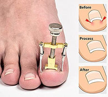 Load image into Gallery viewer, Ingrown Toenail Lifter Correction Tools KIT  Recover Foot