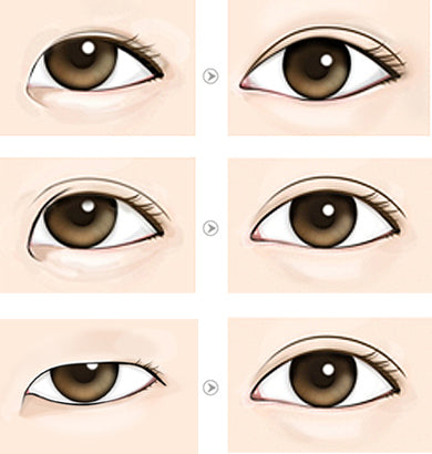 Eye Charm Eyelid tape New Queen Clear 3 mm